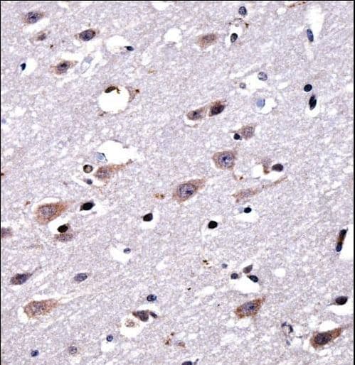 Polyclonal Rabbit anti-Human CREG2 Antibody (aa261-290, IHC, WB)