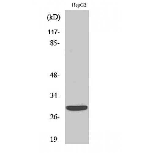 ACBD6 Antibody (90-170 aa, Internal)