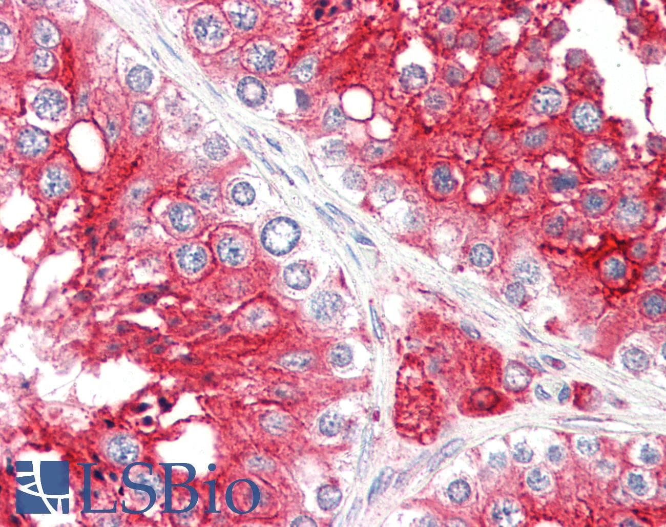 PathPlus™ ACE2 / ACE-2 Antibody