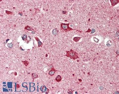IHC-plus™ COPS2 / TRIP15 / ALIEN Antibody