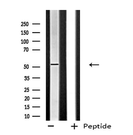 FGFRL1 Antibody