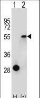 ESRRA / ERR Alpha Antibody (aa131-159)