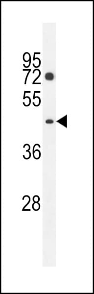 PM20D2 / ACY1L2 Antibody (aa396-425)
