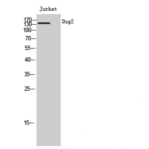 Polyclonal Rabbit anti-Human DSG2 / Desmoglein 2 Antibody (370-450 aa, Internal, WB)
