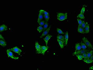 RASGRP1 / RASGRP Antibody