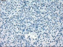 PDE10A Antibody (clone OTI1B2)