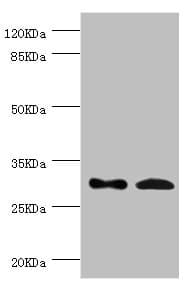 Polyclonal Rabbit anti-Human ZWINT Antibody (IHC, WB)