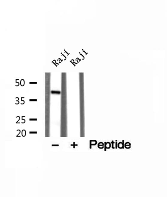 Polyclonal Rabbit anti-Human TIA-1 Antibody (IHC, IF, WB)