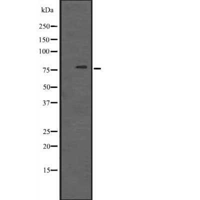 RIPK1 / RIP Antibody
