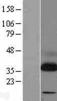 SSR1 Protein (Over-Expression Lysate Myc-DDK (Flag))