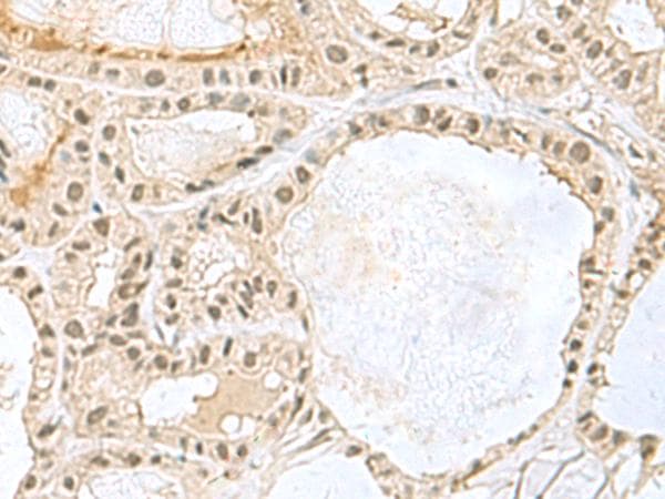 KDM3B / JMJD1B Antibody