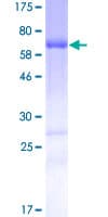 Human STAC Protein (Recombinant GST)