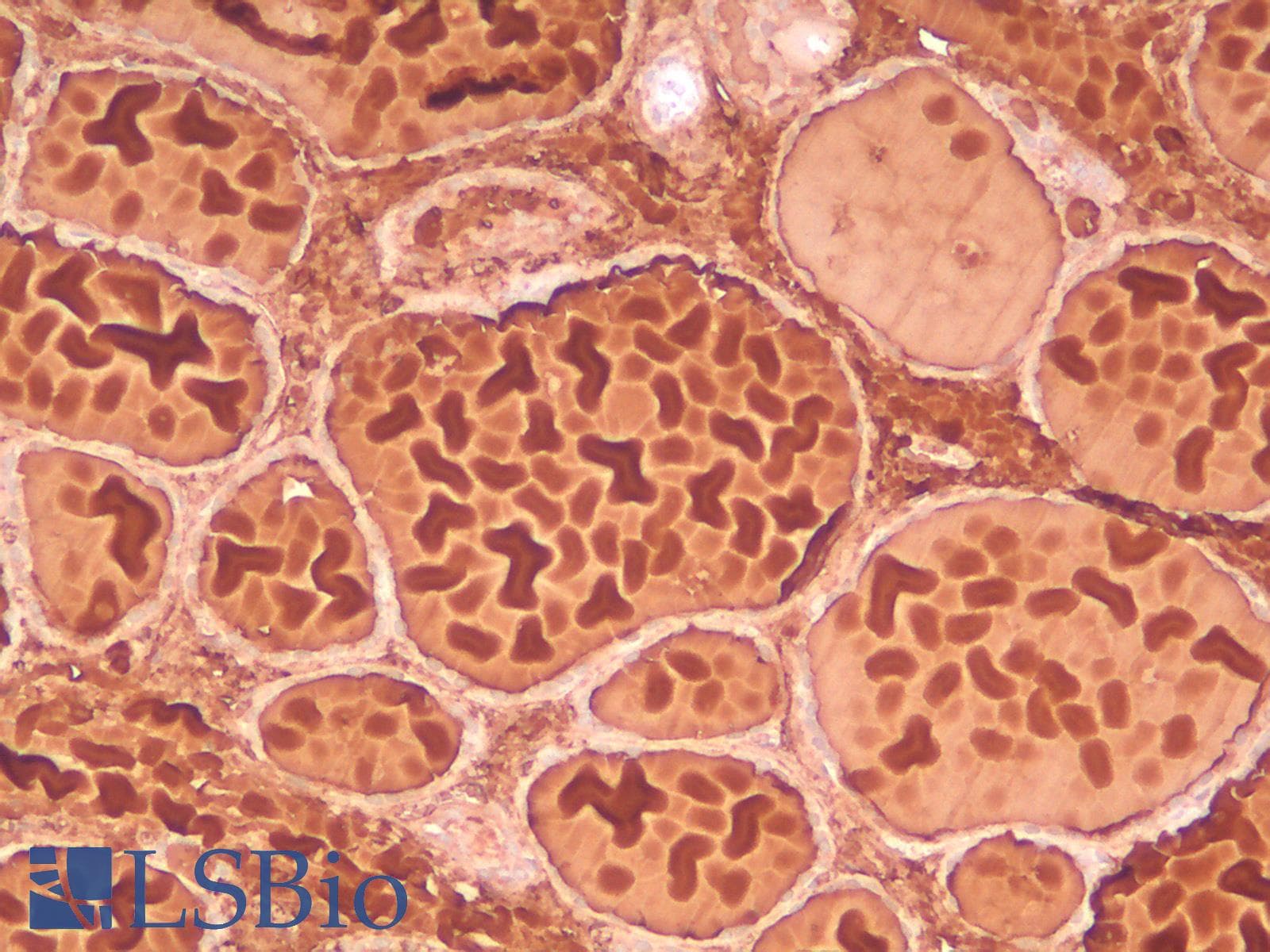 PathPlus™ Monoclonal Mouse anti-Human TG / Thyroglobulin Antibody (Concentrated, IHC, WB)