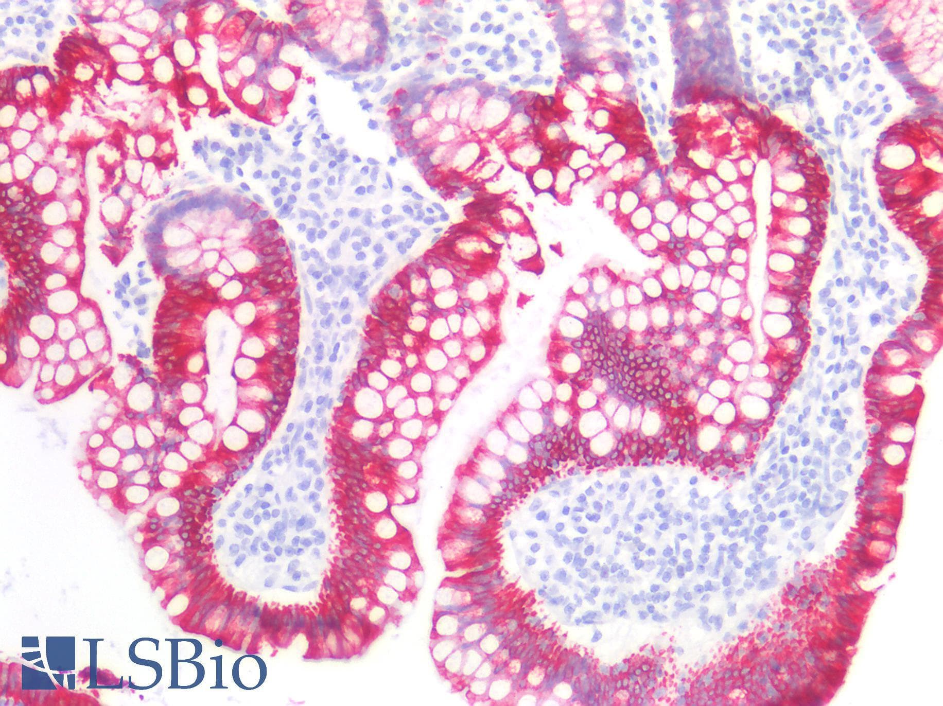 PathPlus™ KRT8 / CK8 / Cytokeratin 8 Antibody (C-Terminus)