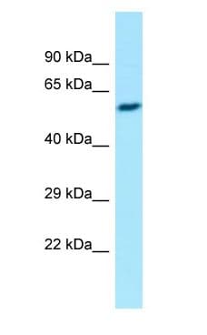 EIF2B3 Antibody (aa217-266)