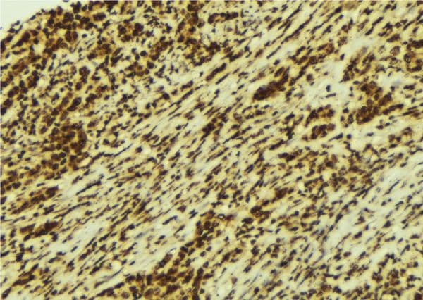 Polyclonal Rabbit anti-Human CSNK1A1 / CK1 Alpha Antibody (IHC, IF, WB)