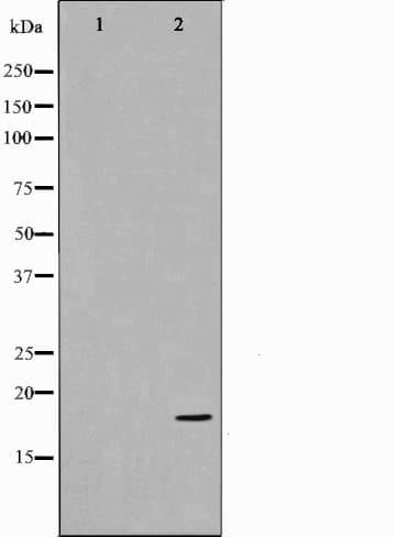 Polyclonal Rabbit anti-Human CDKN2C / p18 INK4c Antibody (IHC, IF, WB)