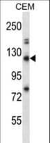 RBBP8 / CTIP Antibody (aa763-792)