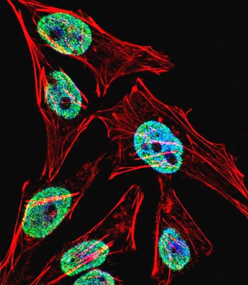 IHC-plus™ TERT / Telomerase Antibody (aa627-656)