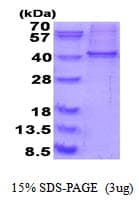Human RALY Protein (Recombinant His)