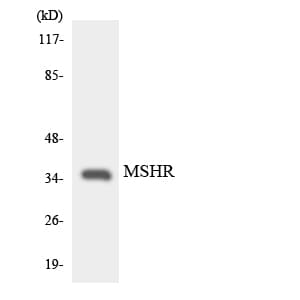 Polyclonal Rabbit anti-Human MC1R Antibody (aa263-312, WB)