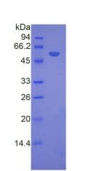 Human FSIP1 Protein (Recombinant His-GST, N-terminus)