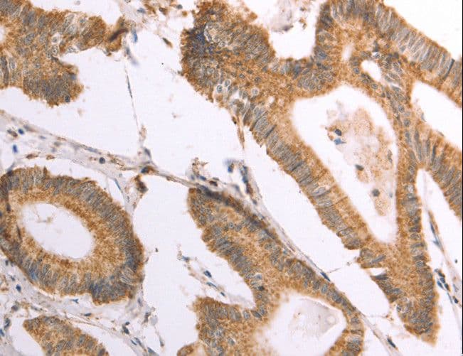 NAMPT / Visfatin Antibody
