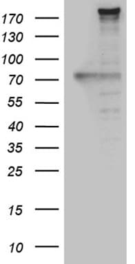 Monoclonal Mouse anti-Human NES / Nestin Antibody (clone OTI3B12, aa99-349, IHC, WB)