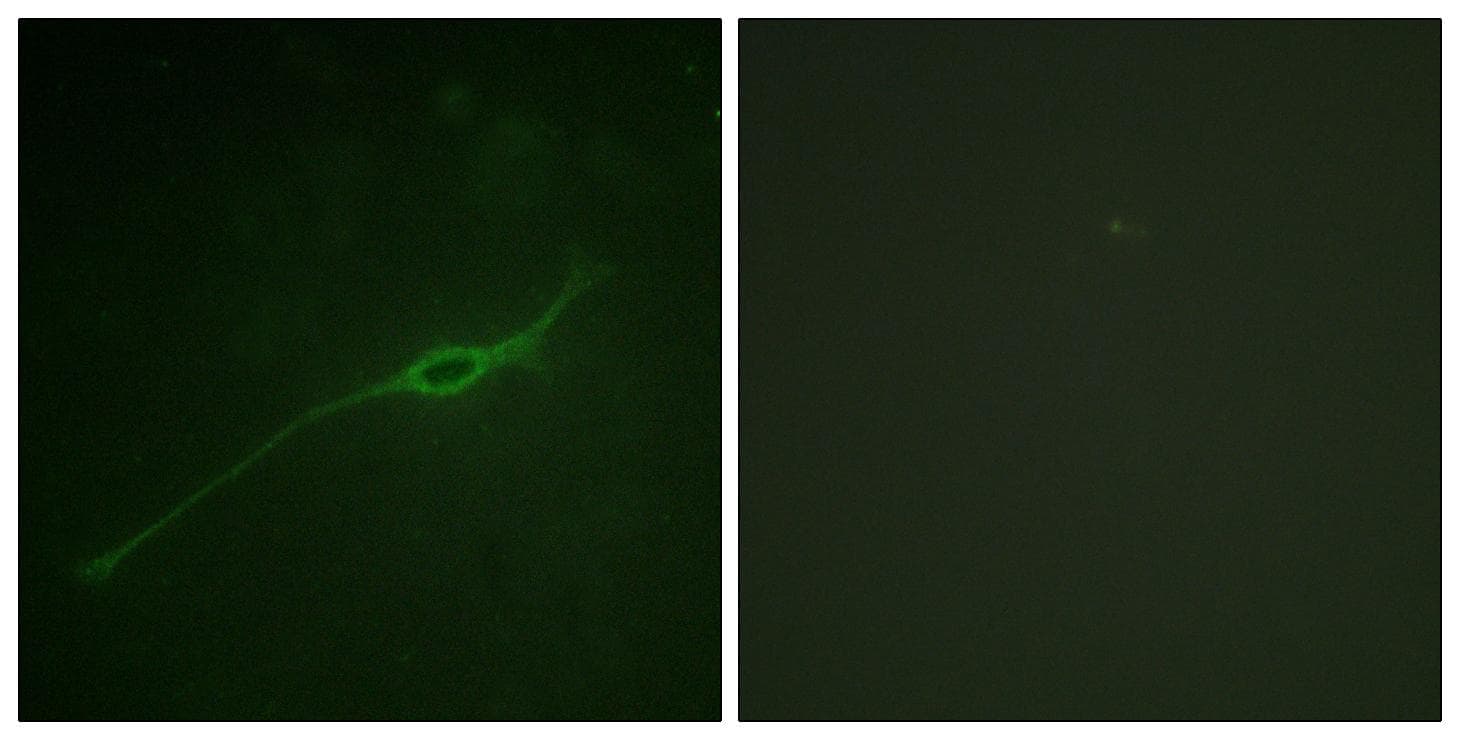 STX1A / Syntaxin 1A Antibody (phospho-Ser14)