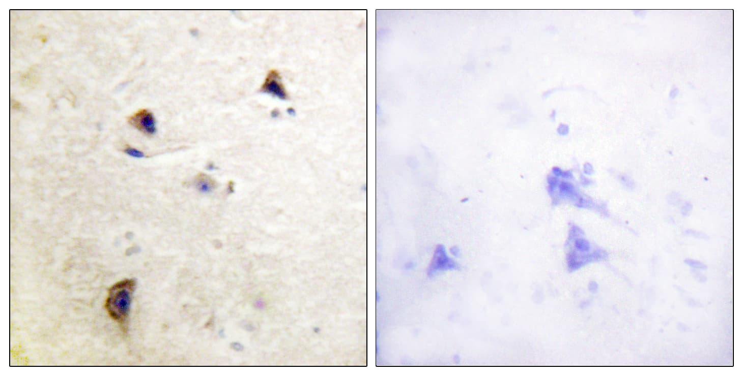 Polyclonal Rabbit anti-Human RPH3A / Rabphilin 3A Antibody (phospho-Ser237, IHC, IF, WB)
