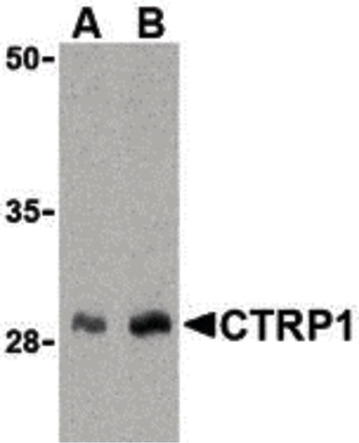 IHC-plus™ Polyclonal Rabbit anti-Human C1QTNF1 / CTRP1 Antibody (IHC, IF, WB)