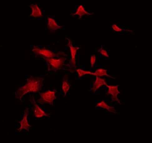 HTS1 / ST5 Antibody
