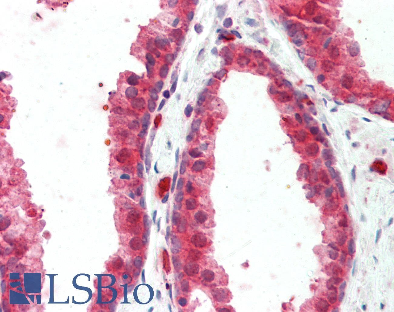 IHC-plus™ CCDC22 Antibody