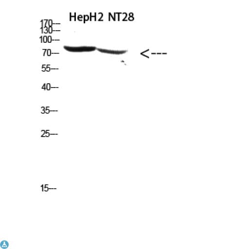 RPS6KA2 / RSK3 Antibody