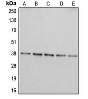 ARG2 / Arginase 2 Antibody (C-Terminus)