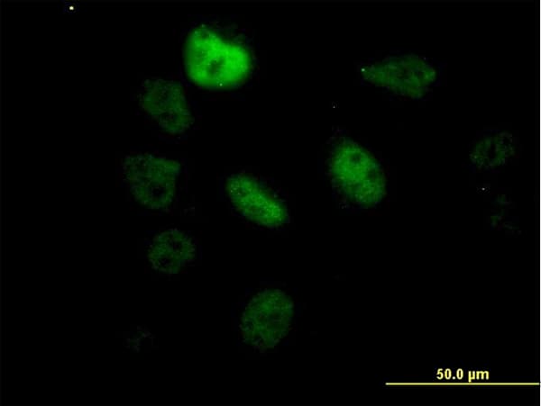 SF3B2 Antibody (clone 5D2)