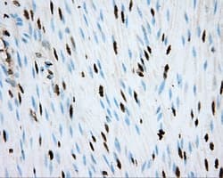 ARNT / HIF-1-Beta Antibody (clone OTI1A1)