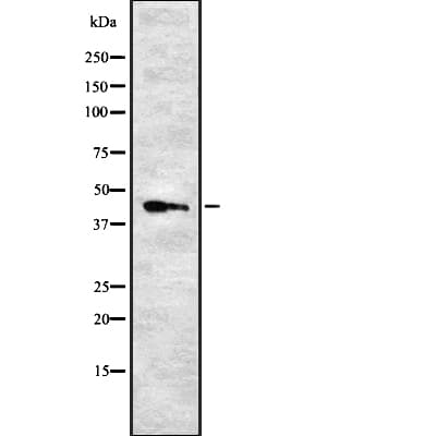 ARRDC2 Antibody