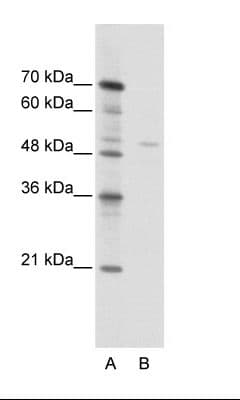 Polyclonal Rabbit anti-Human TRIM38 Antibody (C-Terminus, IHC, WB)