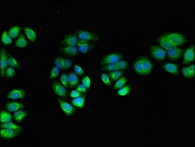 Polyclonal Rabbit anti-Human PPOX Antibody