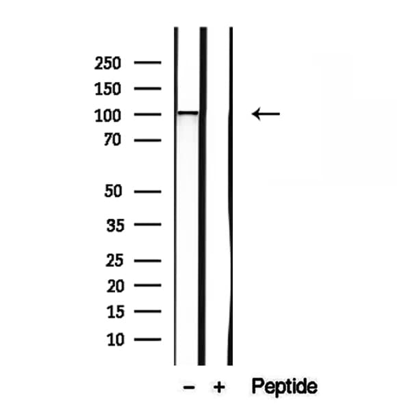 SLC39A6 / LIV-1 Antibody