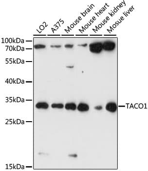 Polyclonal Rabbit anti-Human CCDC44 / TACO1 Antibody (WB)