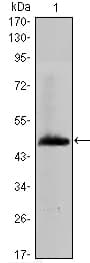 HAS1 / HAS Antibody (clone 3E10)
