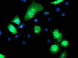RPN1 / Ribophorin I Antibody (clone OTI6F2)