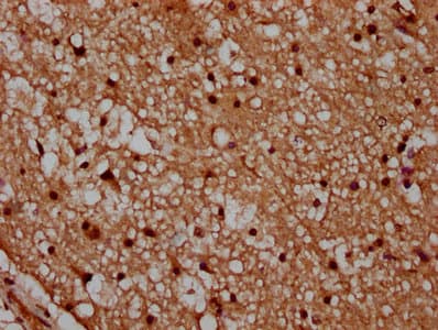HIST1H2AI Antibody
