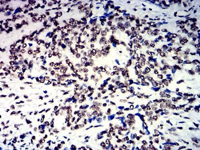 HNRPM / HNRNPM Antibody (clone 5G6C11)