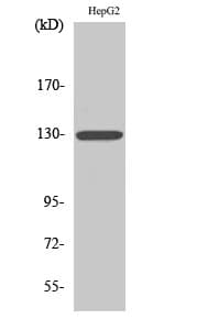 IHC-plus™ Polyclonal Rabbit anti-Human CSF2RB / CD131 Antibody (aa559-608, IHC, WB)