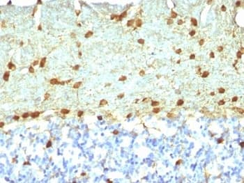FSCN1 / Fascin Antibody (clone FSCN1/418)