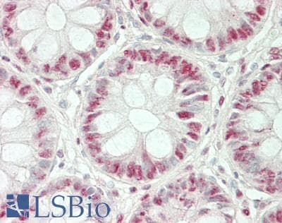 Polyclonal Rabbit anti-Human HDAC1 Antibody (IHC, WB)