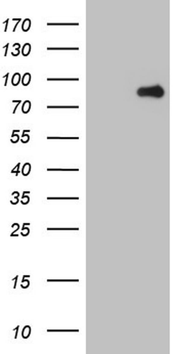 Monoclonal Mouse anti-Human C-TAK1 / MARK3 Antibody (clone OTI3F6, aa473-729, IHC, WB)